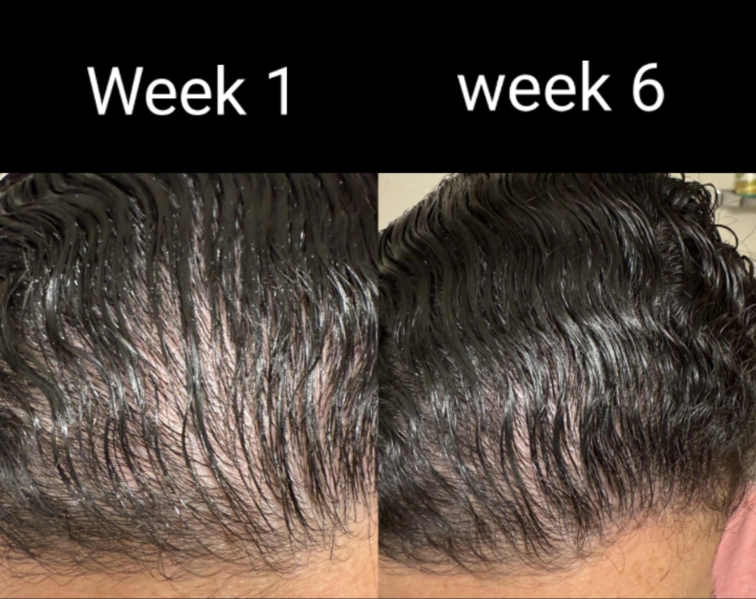 Flourish Follicle Hair Growth Oil & Spray