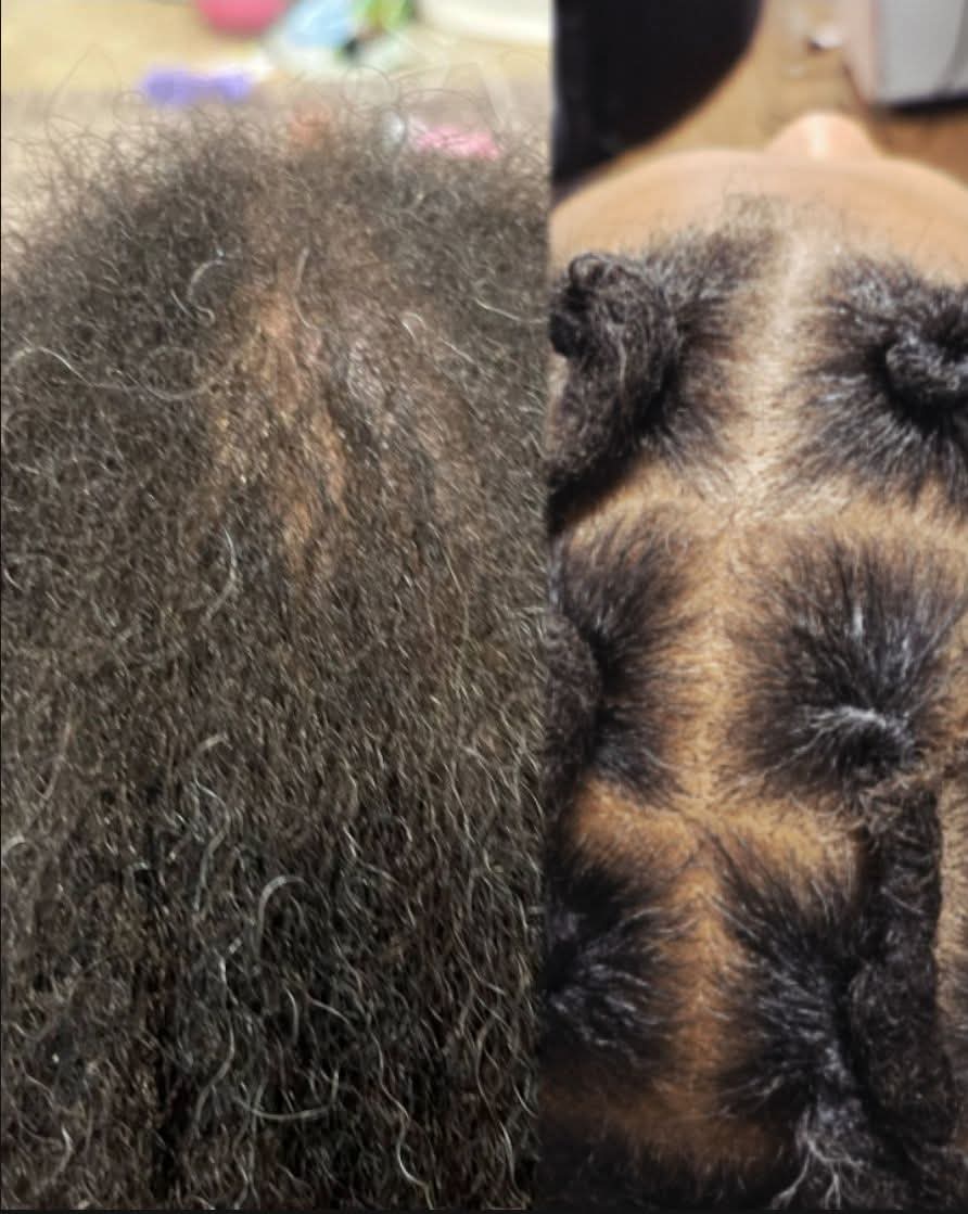 Flourish Follicle Hair Growth Oil & Spray