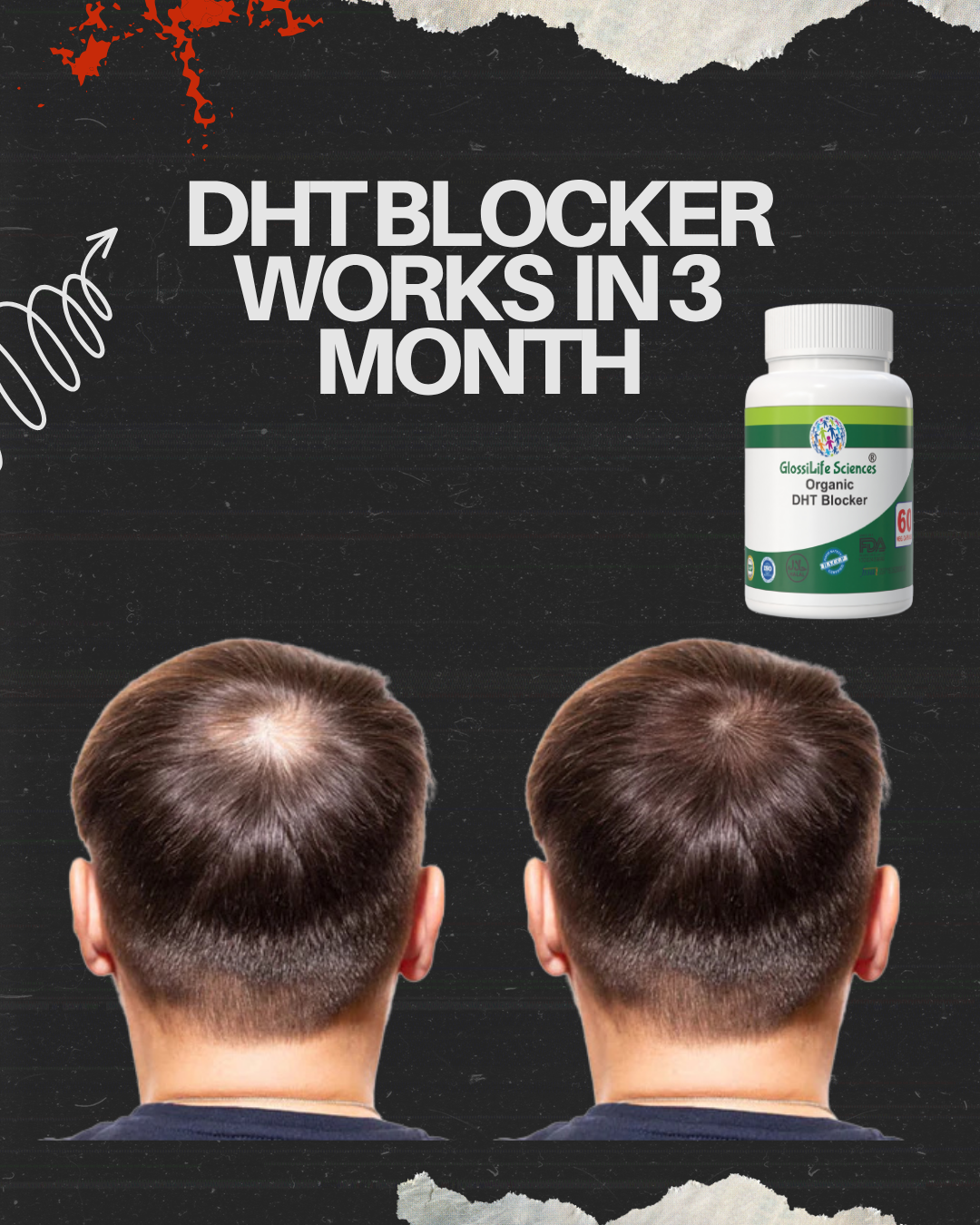 GlossiLife Sciences Organic DHT Blocker 60 Capsule