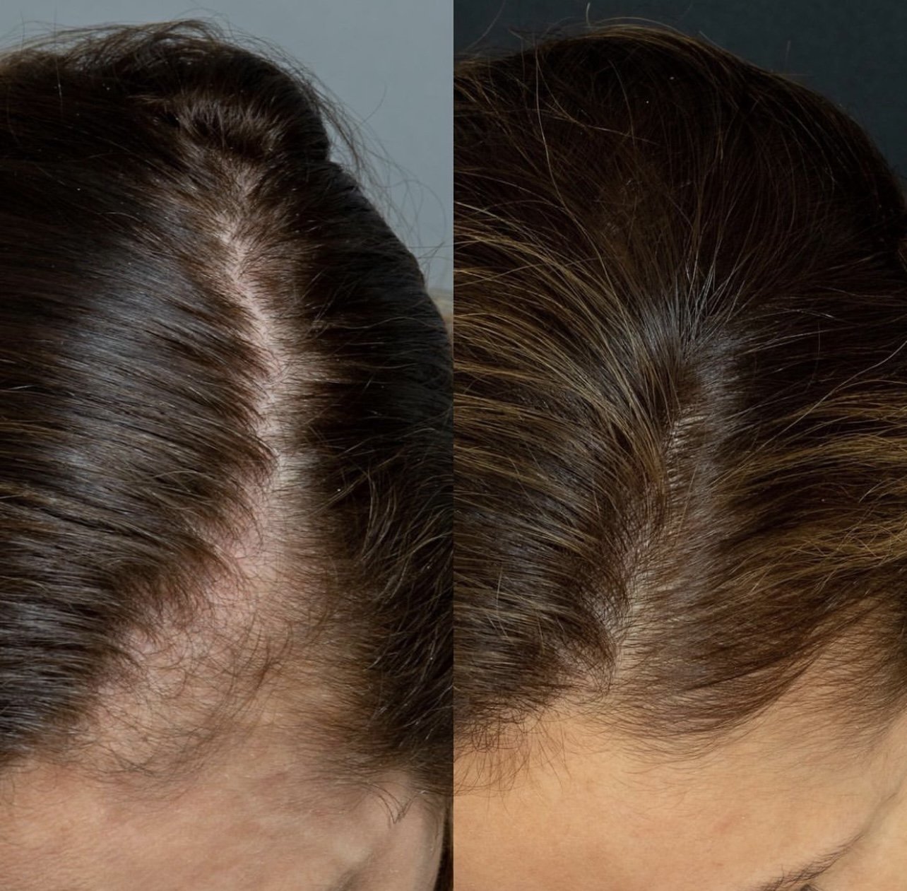 GlossLife Sciences Hair Growth Supplement
