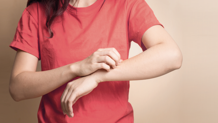 PRUDengue Medcare | PDF