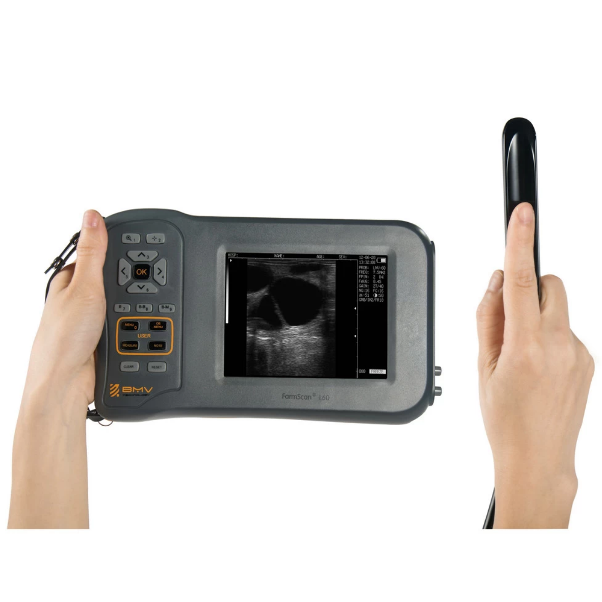 FarmScan® L60 Compact Handhold Veterinary Ultrasound