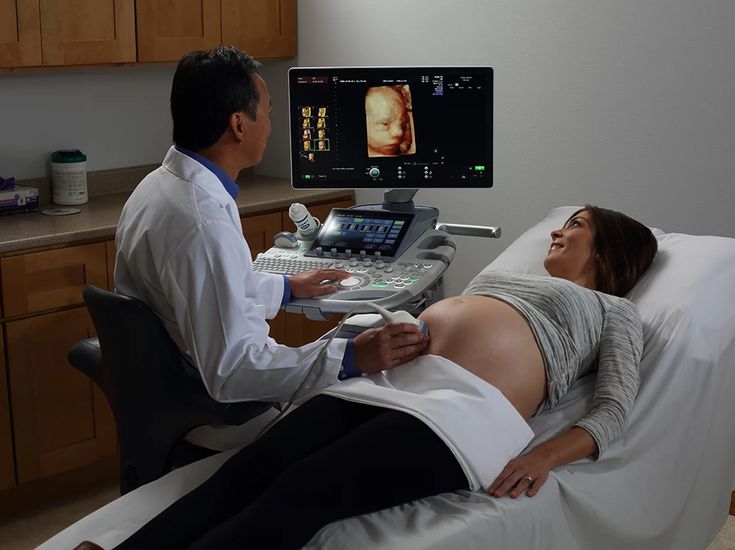 Exceptional 4D Scan