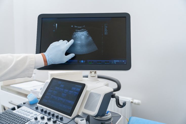 Endometrial Lining Scan
