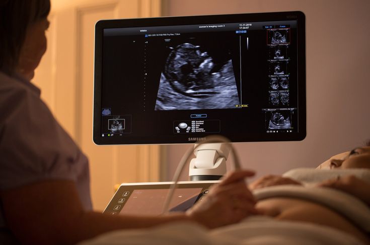 Well-Being Scan
