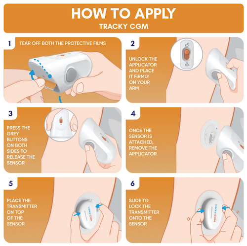 Tracky CGM Continuous Glucose Monitoring System - Sensor 1 pcs