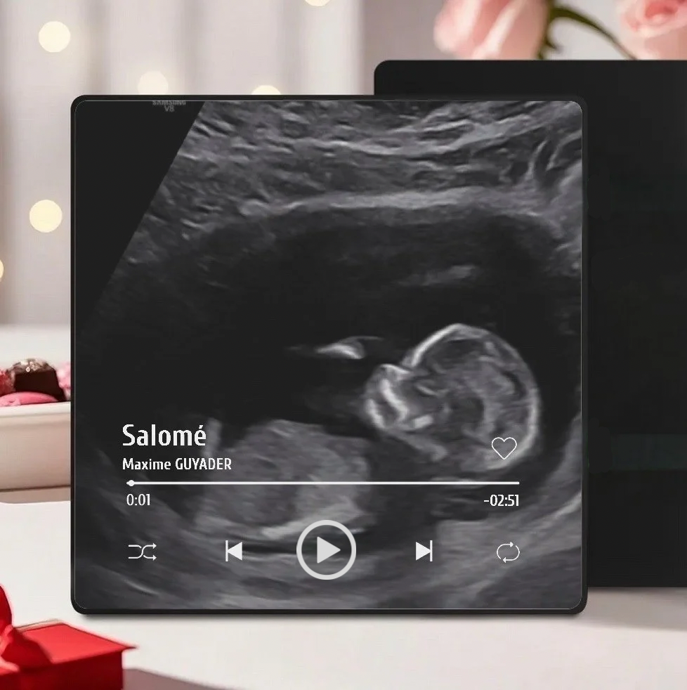 Cadre photo musical avec musique personnalisée 