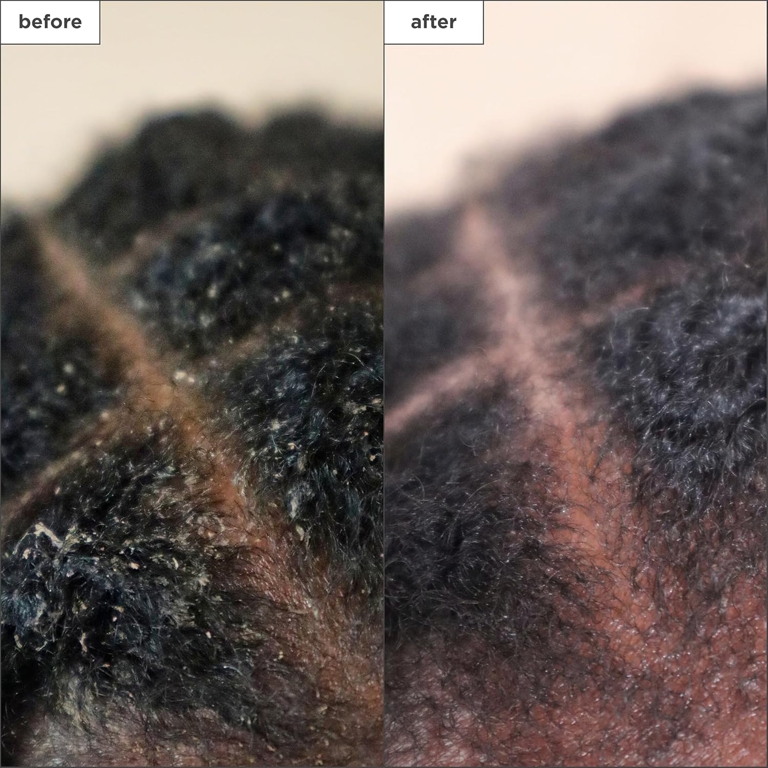 Briogeo Scalp Revival Charcoal + Tea Tree Scalp Treatment