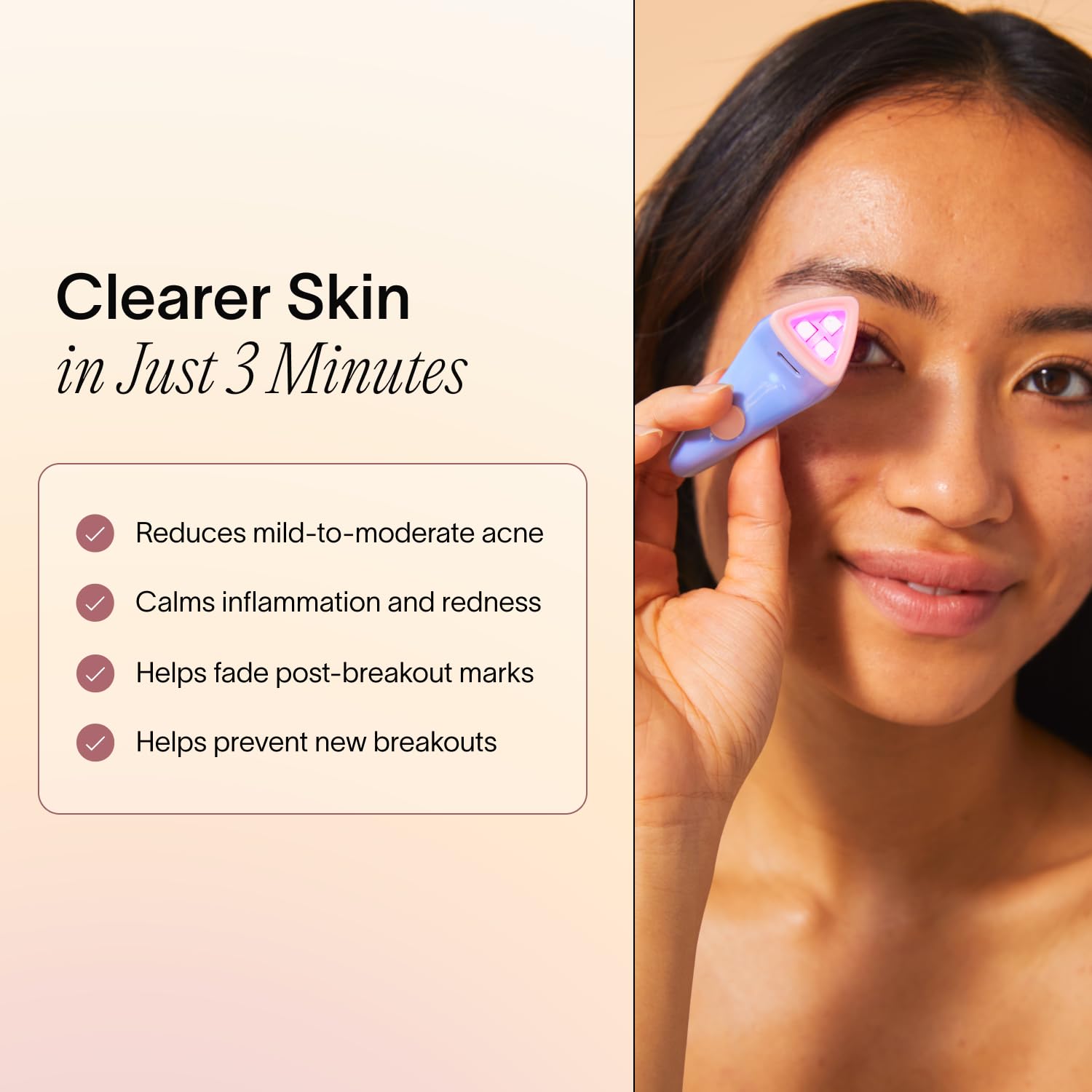 Solawave Acne Spot Treatment | Blue and Red Light Therapy Device for Pimples and Blemishes
