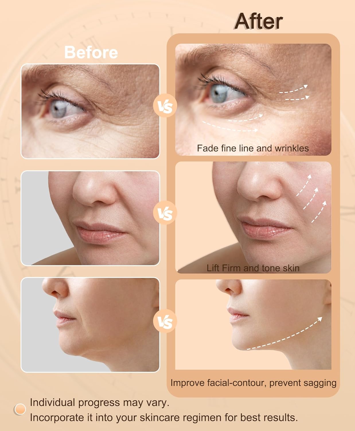 Radio Frequency Skin Tightening Device | 6-in-1 RF Facial Beauty Device | Professional Facial Skin Tightening | Lifting | Wrinkle Reduction | Anti-aging |