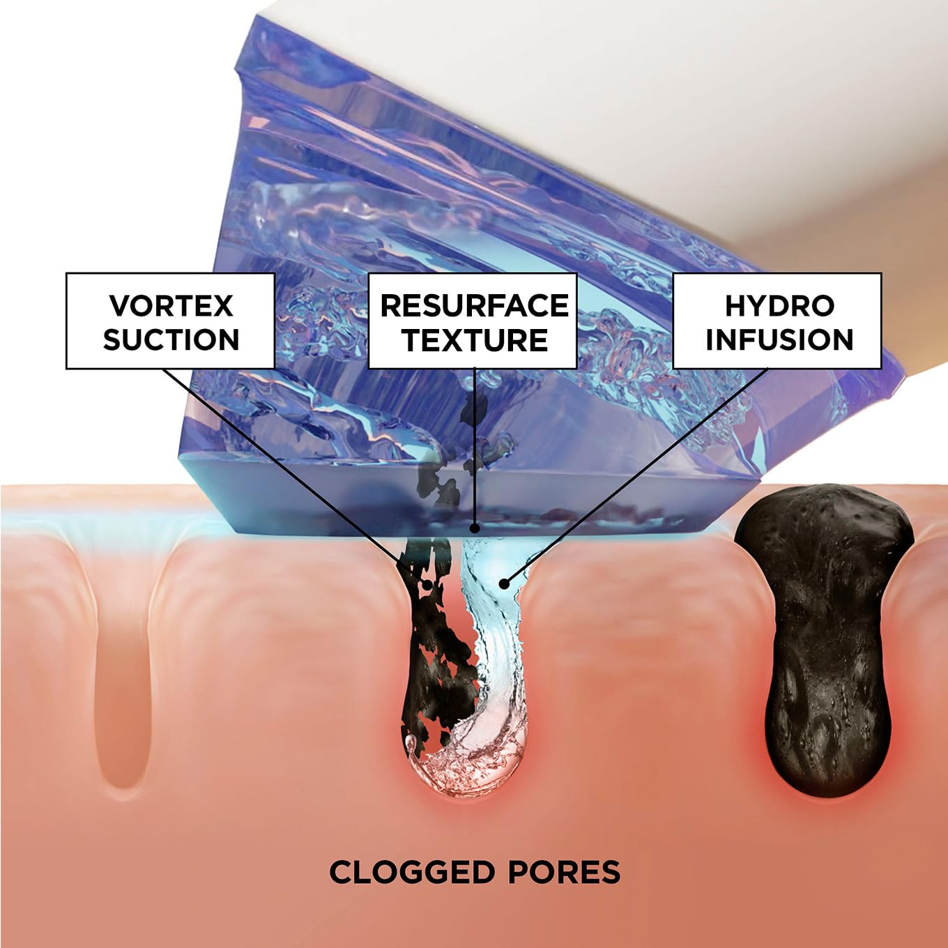 BeautyBio GLOfacial Hydro-Infusion Deep Pore Cleansing + Blue LED Clarifying Set: Tool + Concentrate
