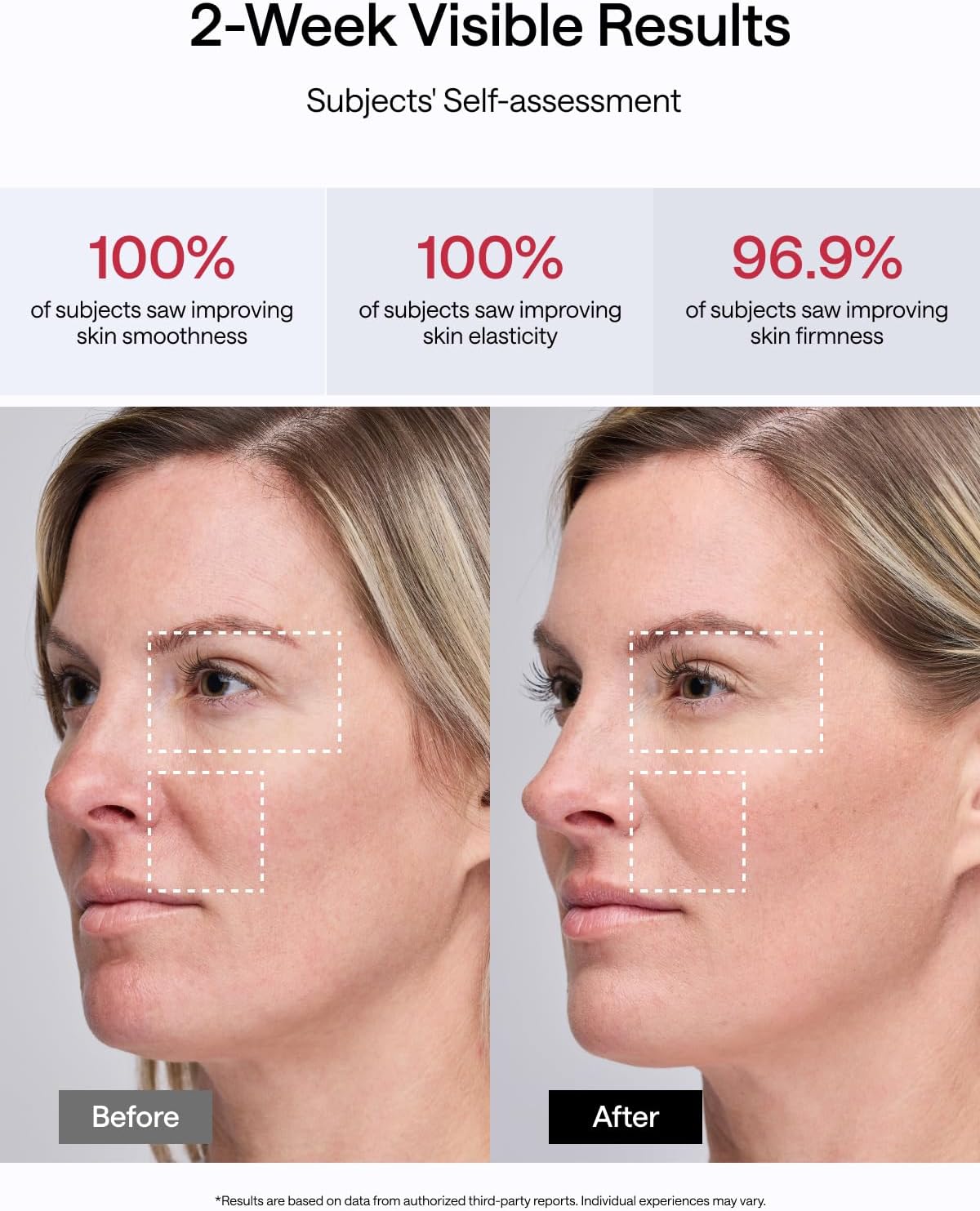 JMOON NouvelleSkin Facial Toning Device, FDA Approved Microcurrent Facial Device & Red Light Therapy for Face, 4 Modes & 5 Intensity Levels for Tightening