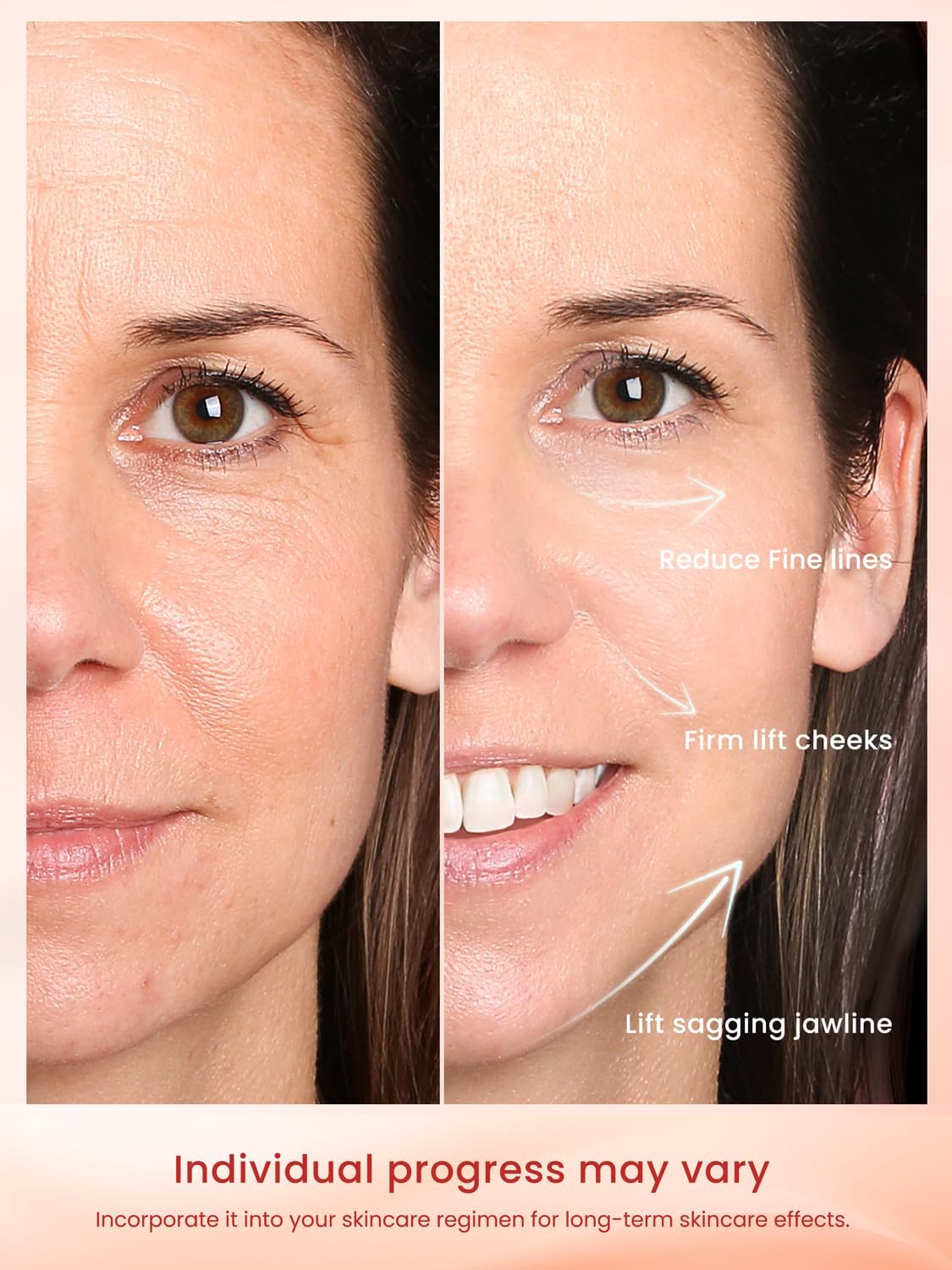 Radio Frequency Skin Tightening Device, Professional Wireless Home RF Facial Machine for Anti-aging, Wrinkle Reduction, Lifting, Firming with 3 Levels