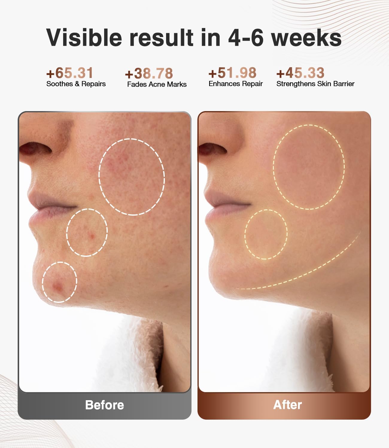 JOVS Red Light Therapy Face Mask, Rechargeable Near Infrared LED Facial Mask