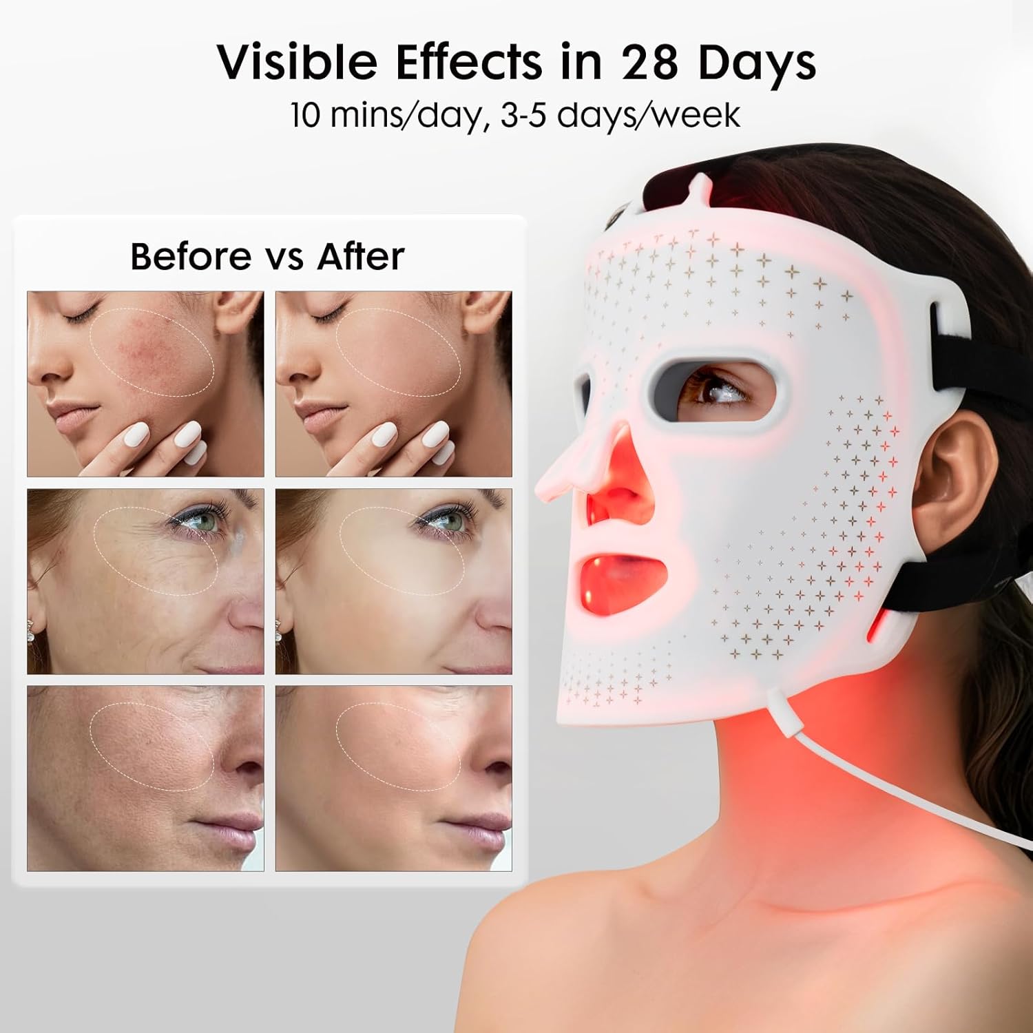 LED Light Therapy Face Mask, FDA Approved, 4 Modes Red Light Therapy for Face