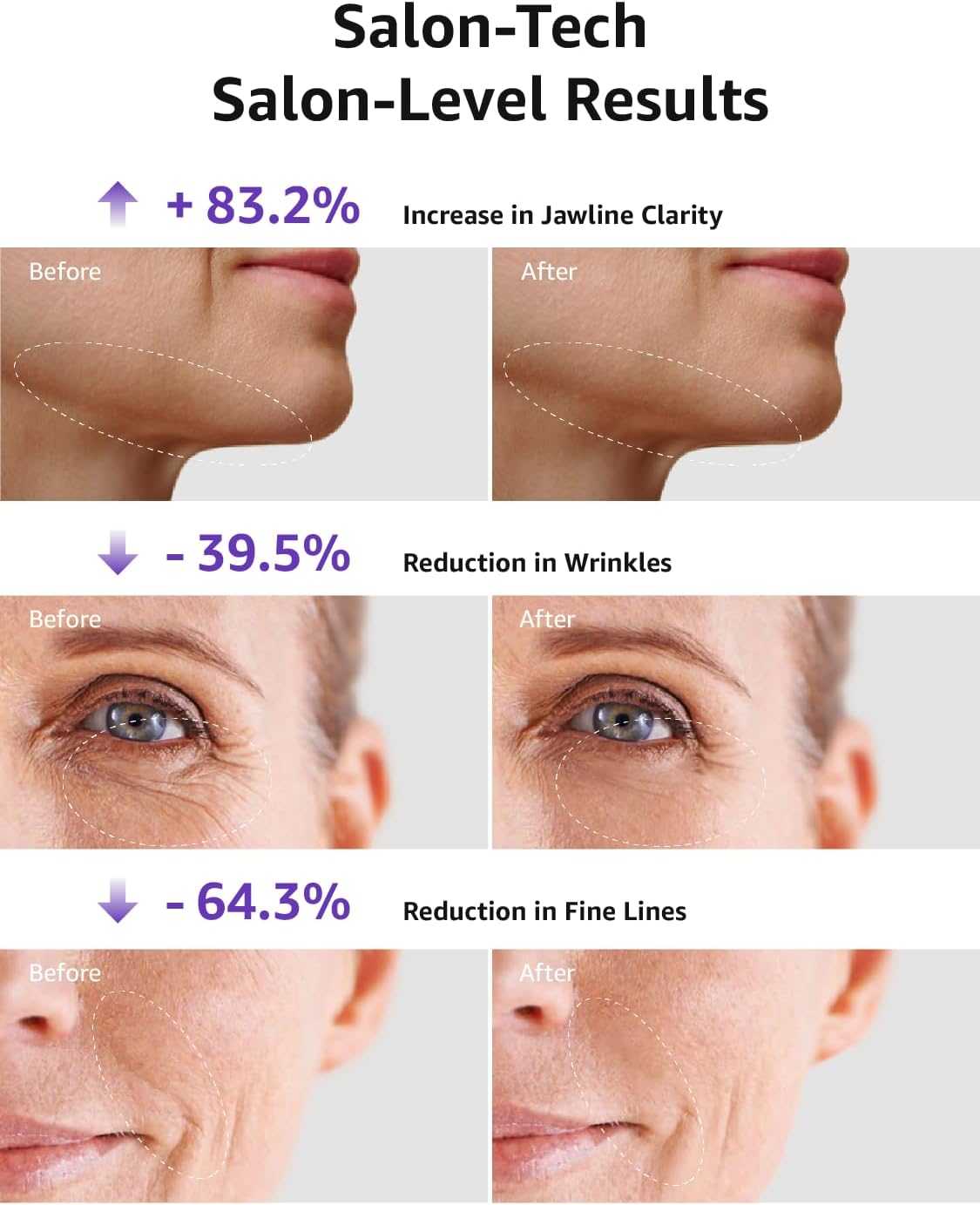 Skin Tightening Facial Machine, Light Therapy Facial Massager for Face