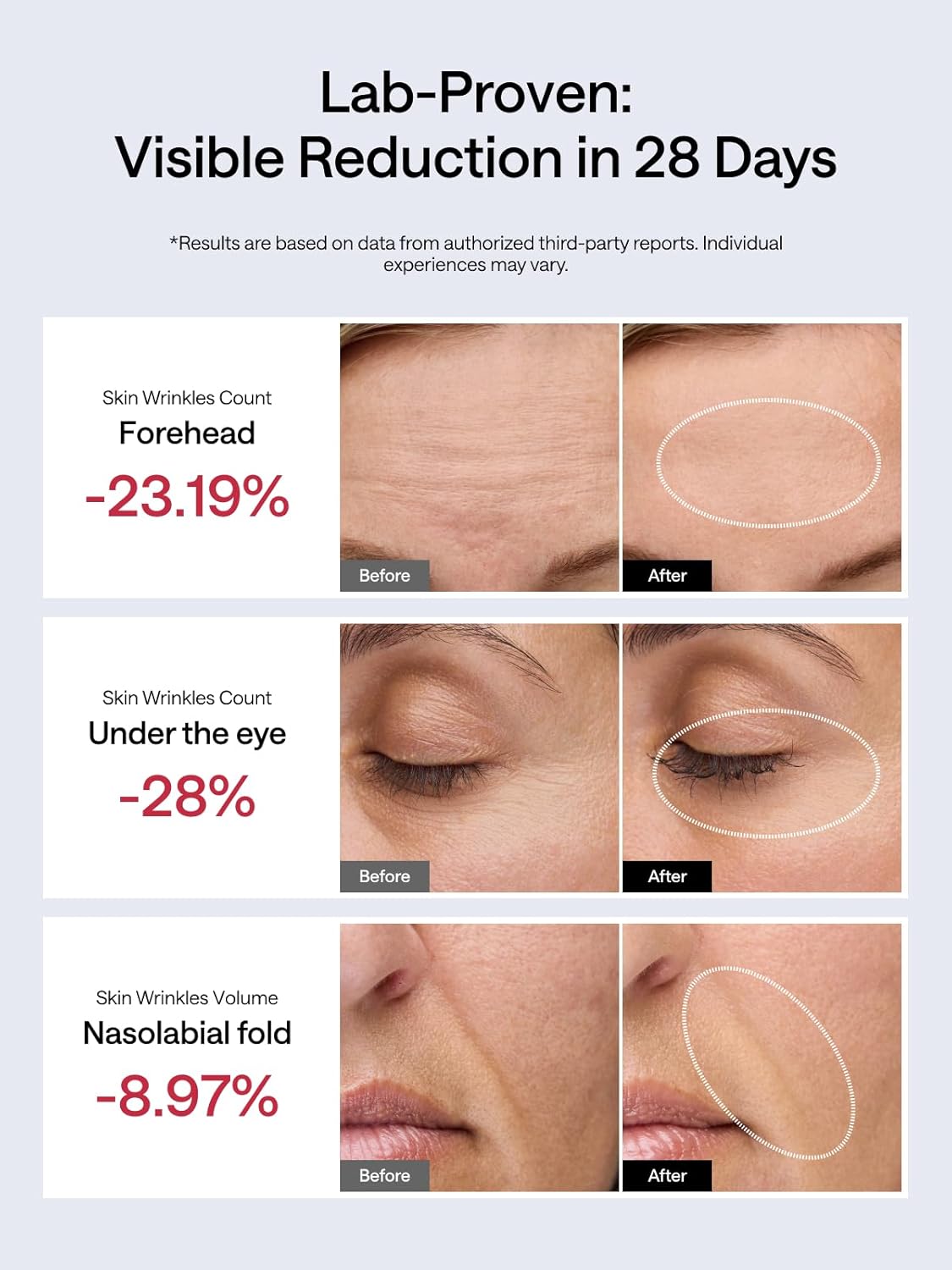 JMOON NouvelleSkin Facial Toning Device, FDA Approved Microcurrent Facial Device & Red Light Therapy for Face, 4 Modes & 5 Intensity Levels for Tightening