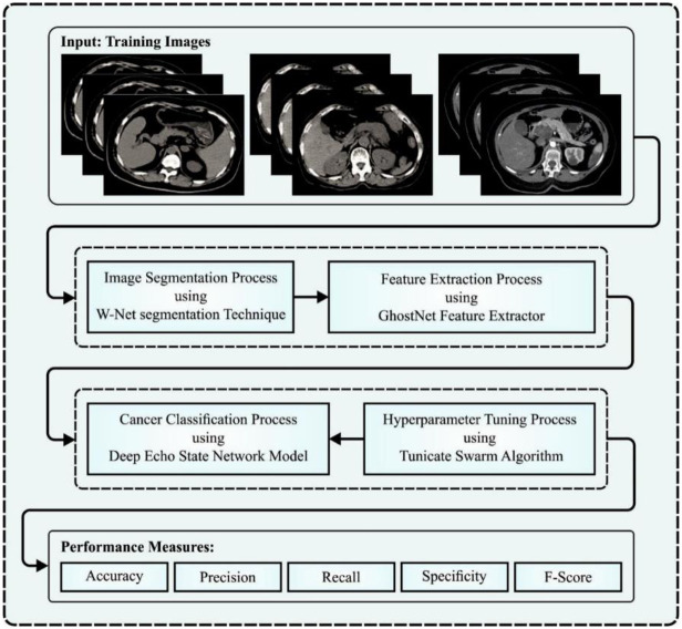 Pancreatic Cancer Detection System using ML
