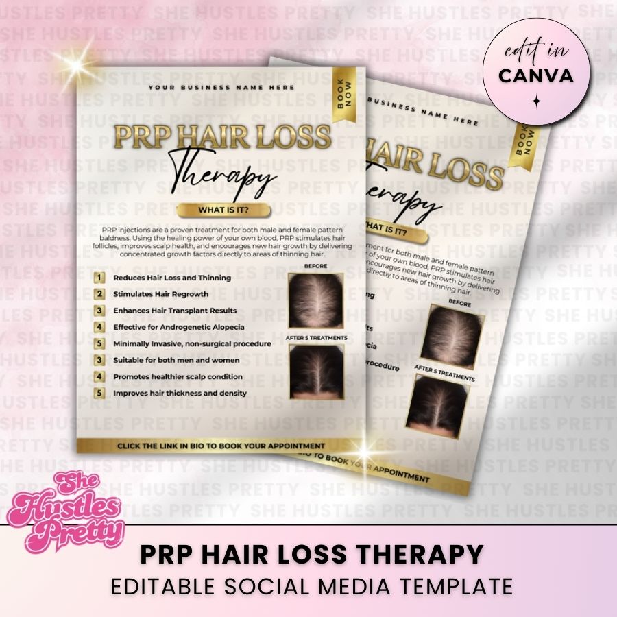 PRP Hair Loss Therapy Social Media Template | Beige & Gold Luxe | For Aestheticians