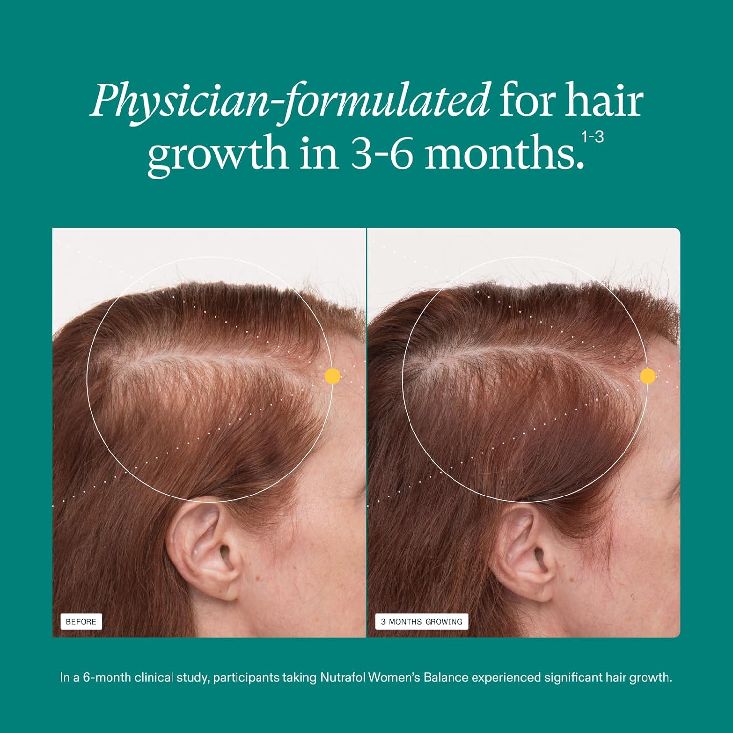 Nutrafol Women's Ages 45 and Up Balance Hair Growth Supplements,, Clinically Proven for Visibly Thicker Hair and Scalp Coverage, Dermatologist Recommended - 1 Month Supply