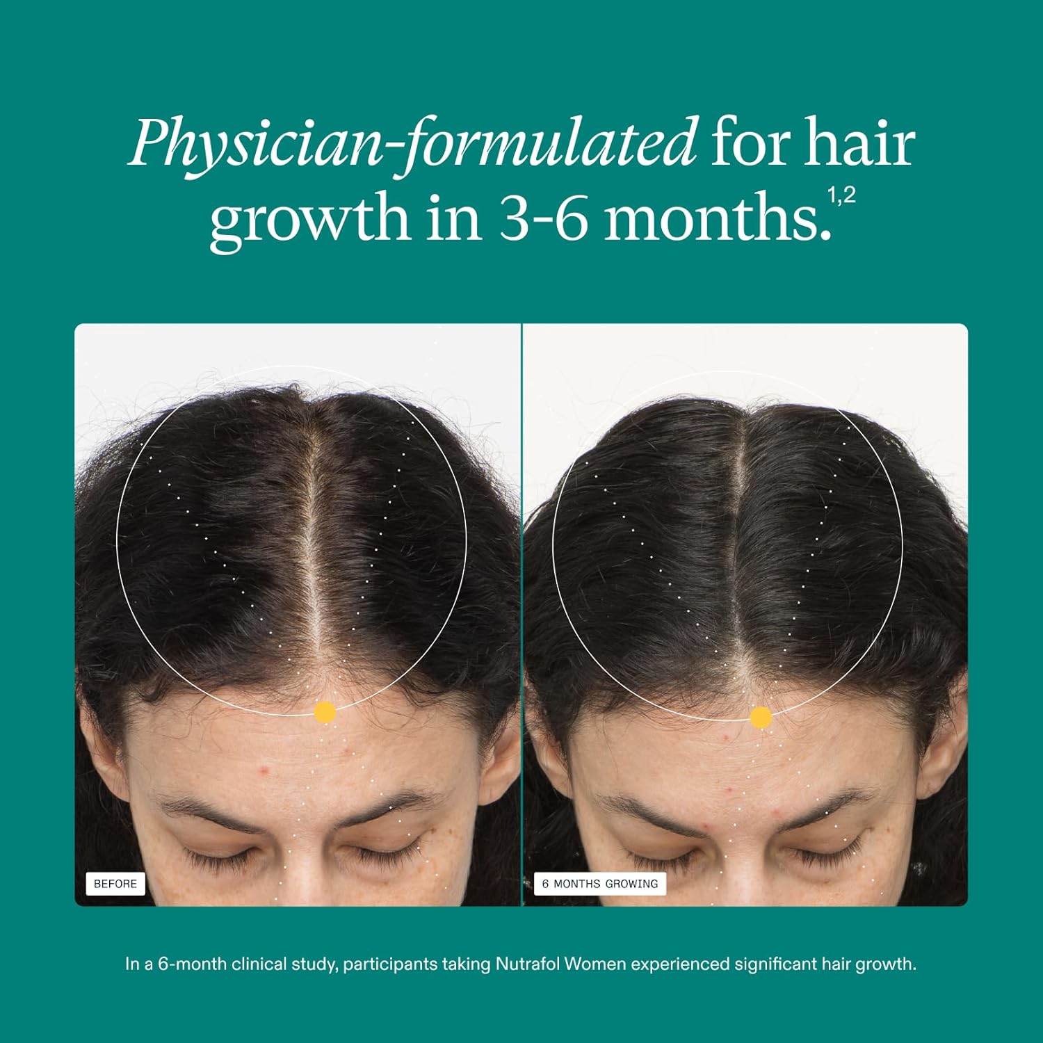 Nutrafol Women's Ages 18-44, Hair Growth Supplements, Clinically Proven for Visibly Thicker and Stronger Hair, Dermatologist Recommended - 1 Month Supply