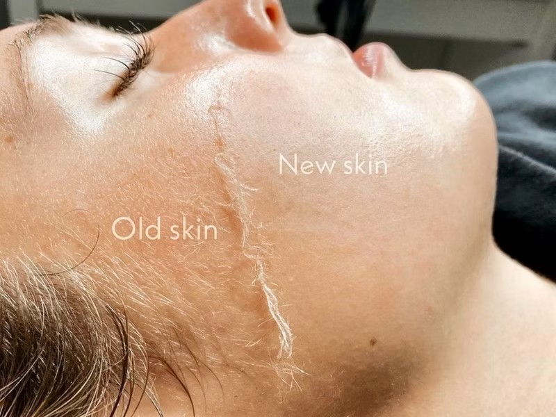 Luxe Dermaplaning Facial