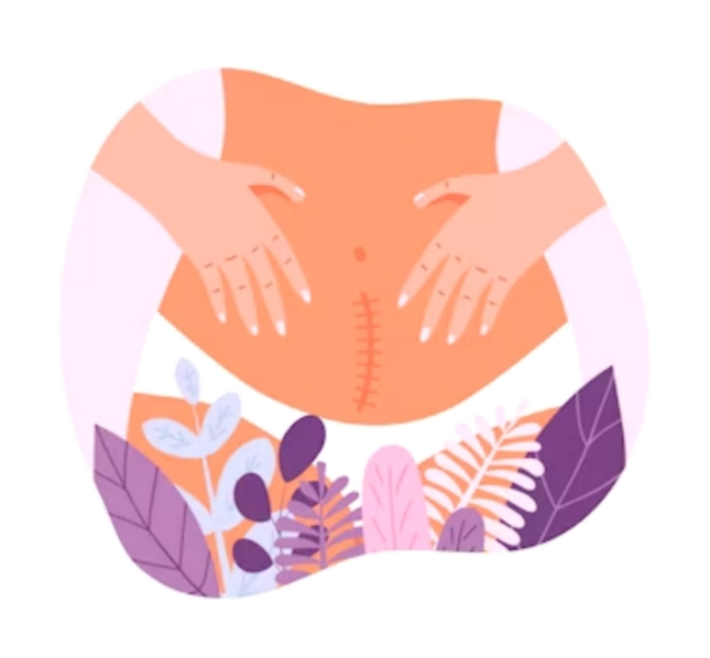 Stomach - Rica Wax