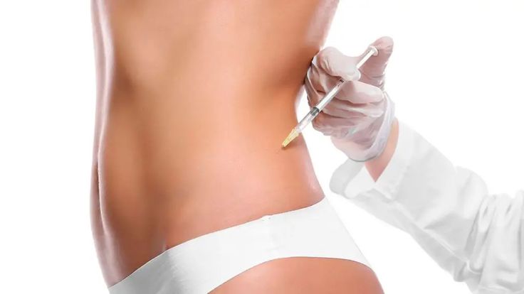 Mesoterapia Corporal