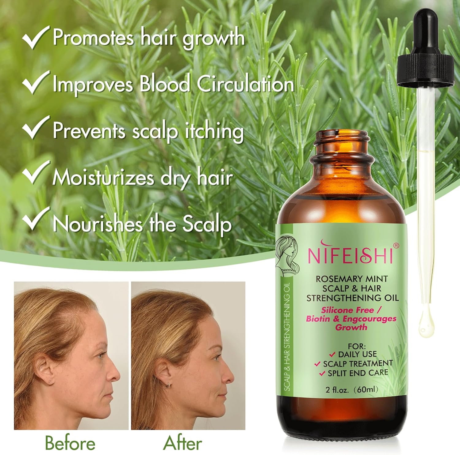 Huile Romarin pour Cheveux Pousse et Chute des Cheveux, Stimule la Croissance, Nourrir le Cuir Chevelu e Renforcer les Cheveux, 60 ml