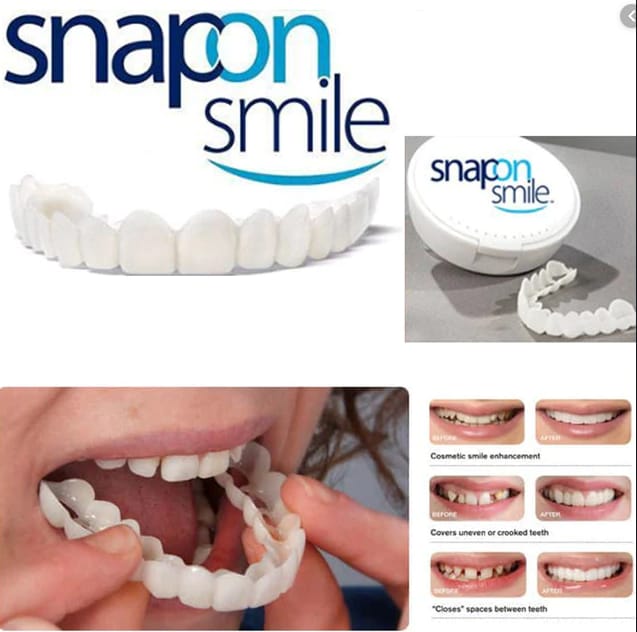 Snap On Smile Dentures