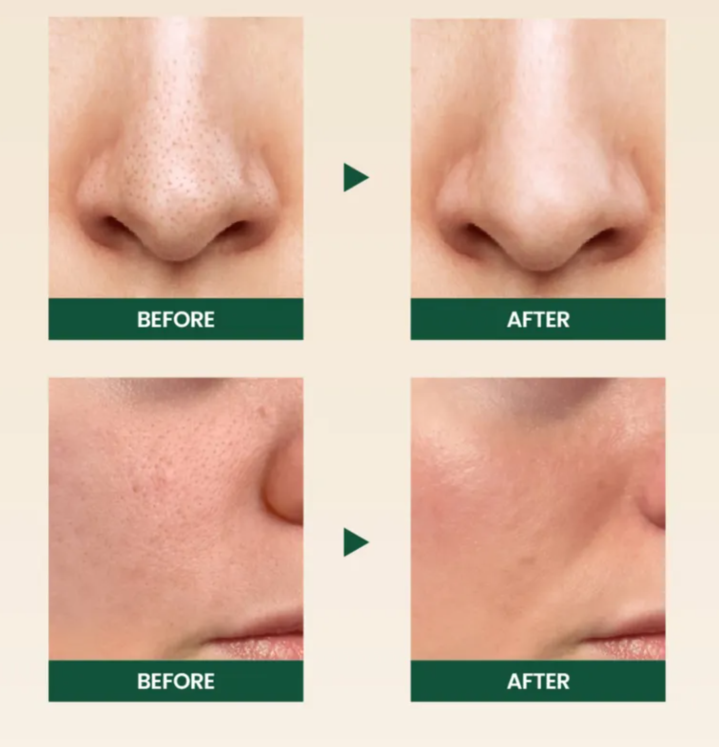 KSECRET – Espuma Limpiadora SEOUL 1988 : Pine Cica 1% + Probióticos