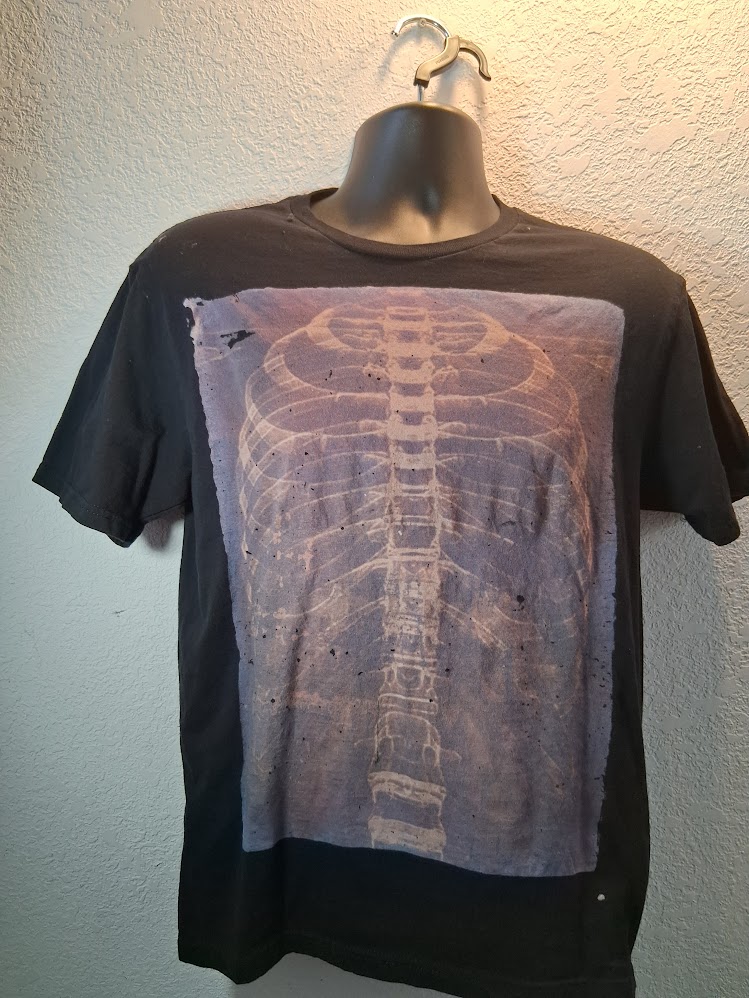 Ribs X- ray