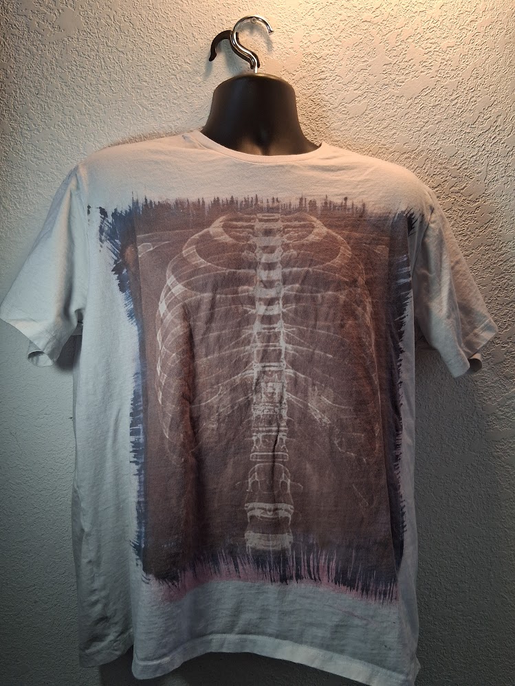 Ribs X- ray