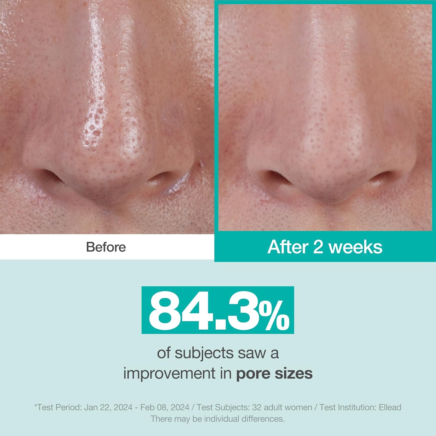 Physiogel Hypoallergenic Red Soothing Cica Balance Pore-Control Serum