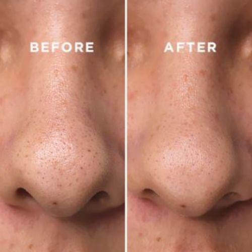 COSRX BHA Blackhead Power Liquid 