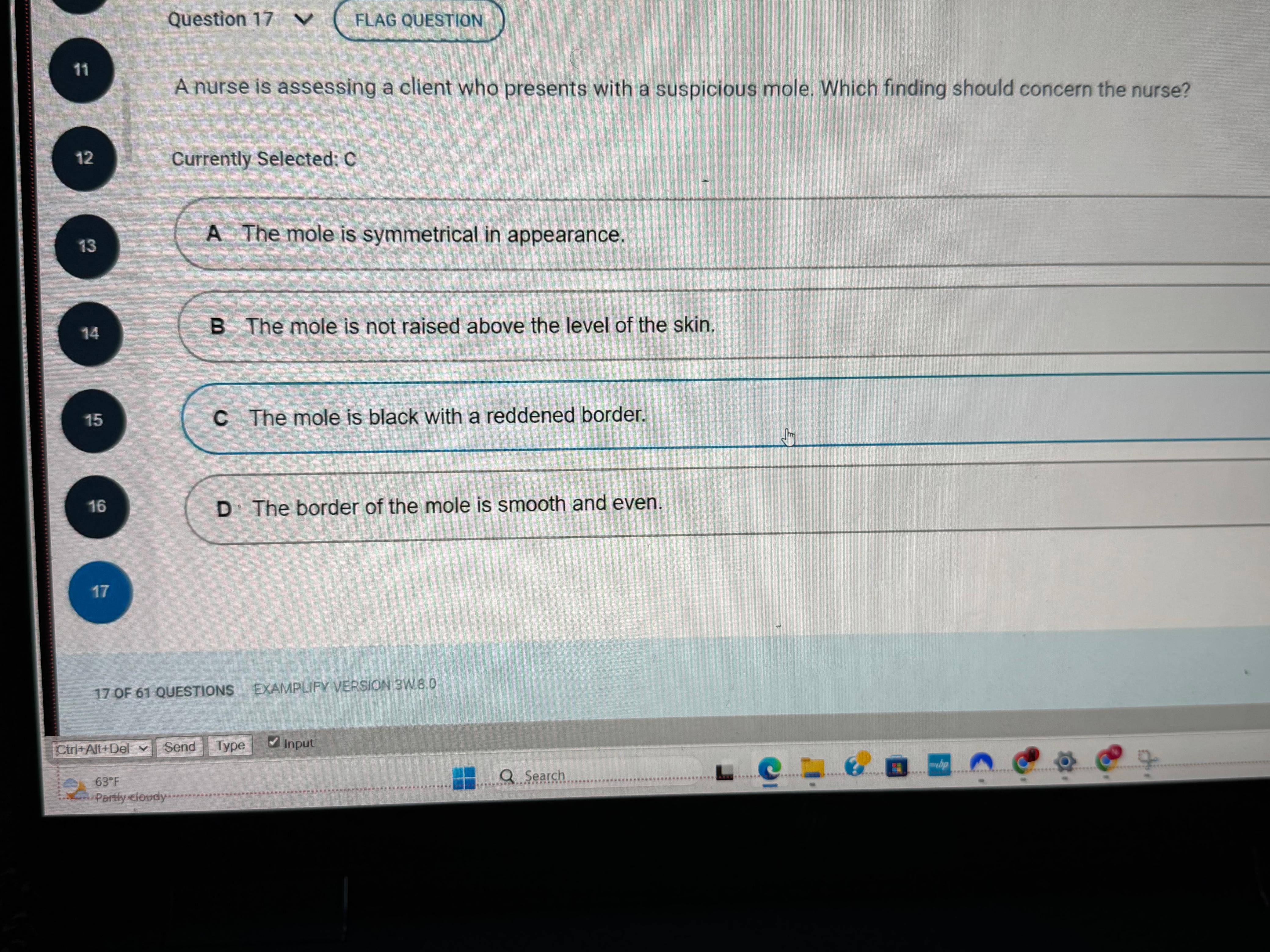 NR 302 Health Assessment 1 Exam 2 – Version 2532