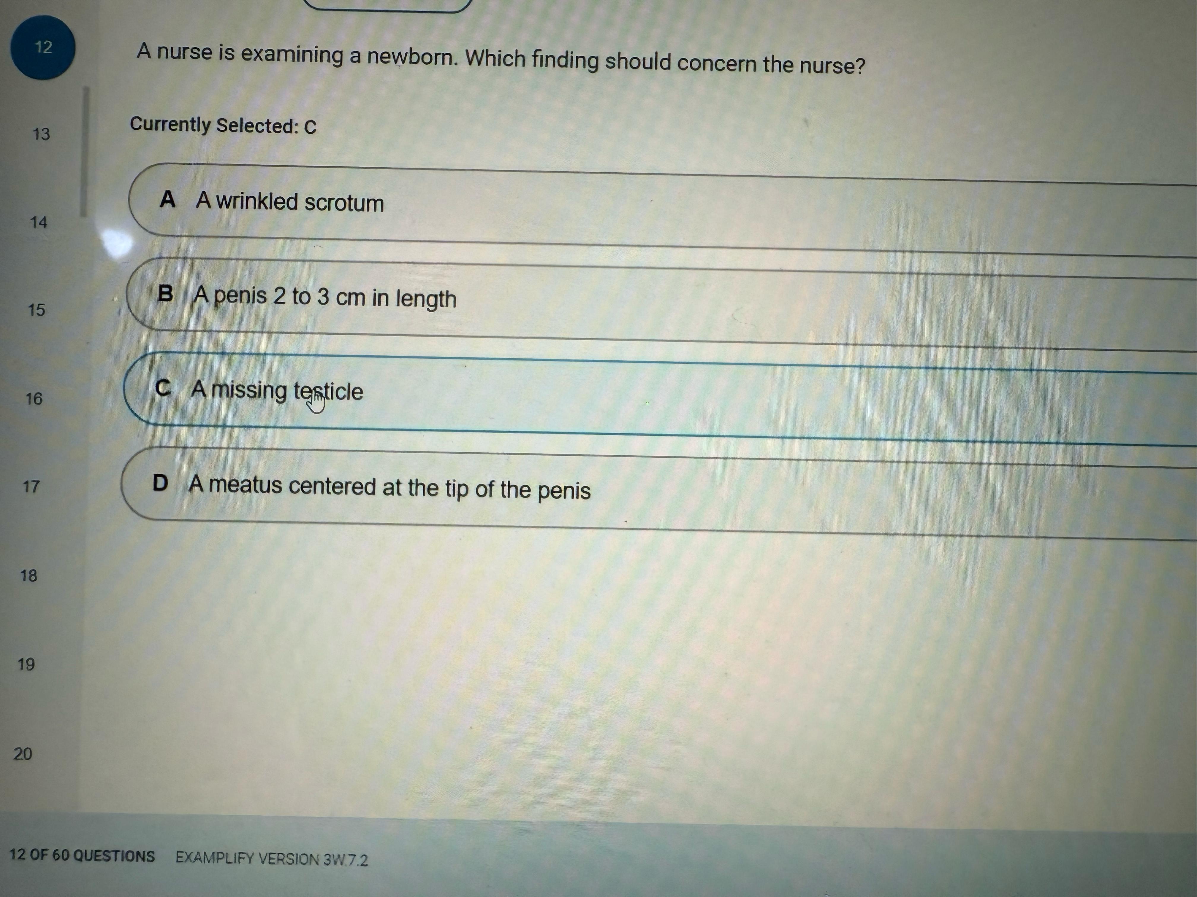NR 304 Health Assesment II Exam 2