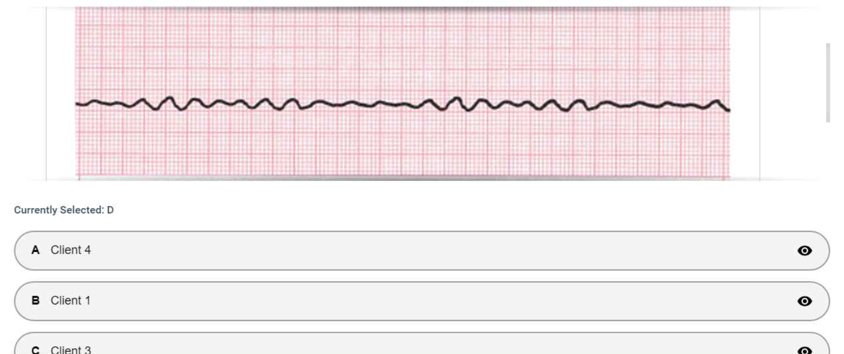 NR 324 Adult Health I New Exam 1 