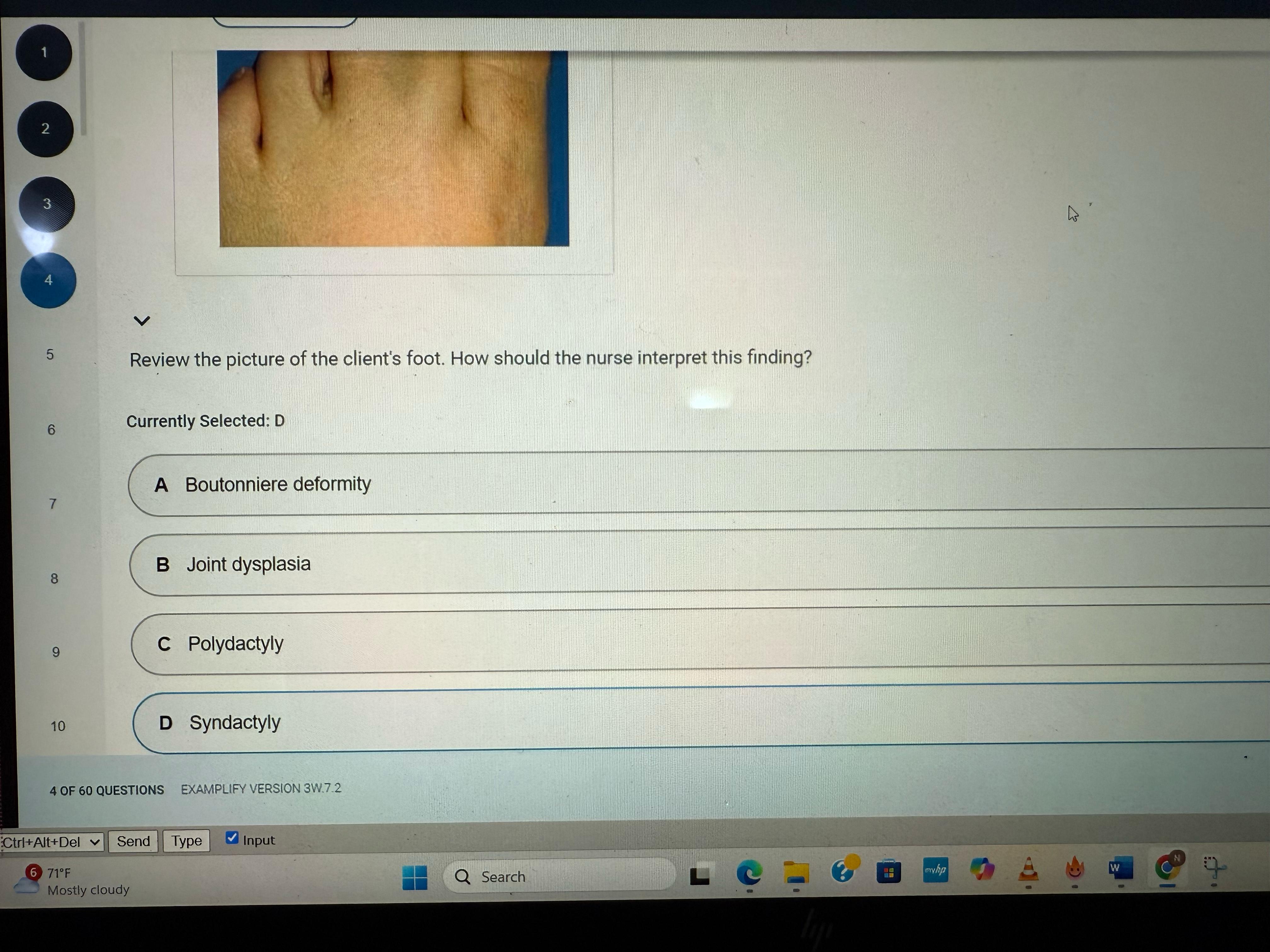 NR 304 Health Assesment II Exam 2