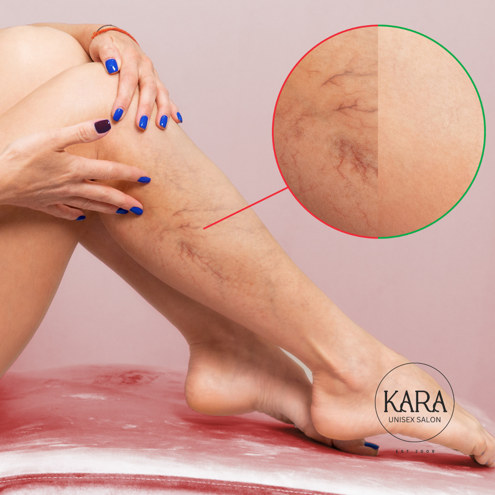 Tan Removal - D TAN