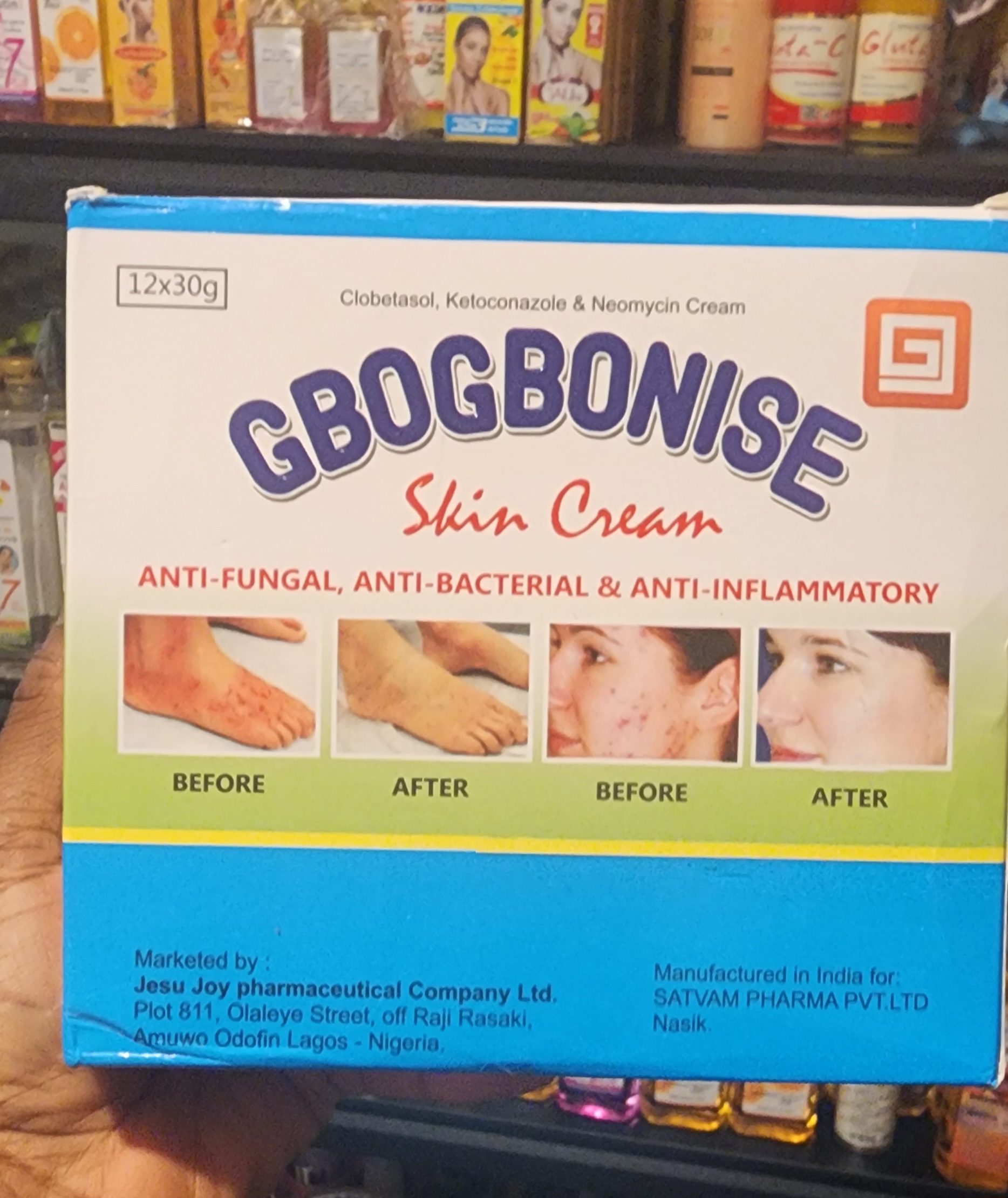 Gbogbonise Skin Cream