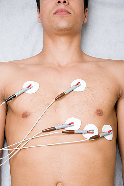 Electrocardiogram (ECG) Electrodes