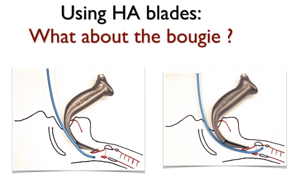 HA Laryngoscope Blade