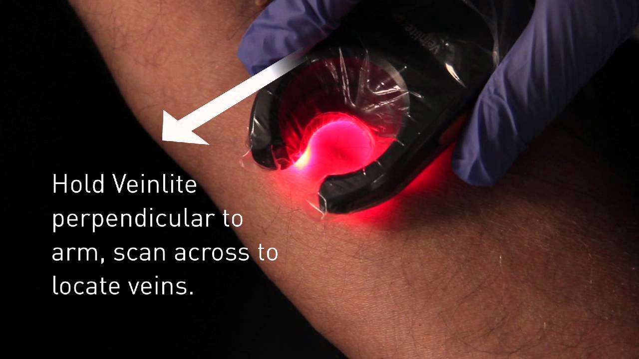 Veinlite Vein Finder