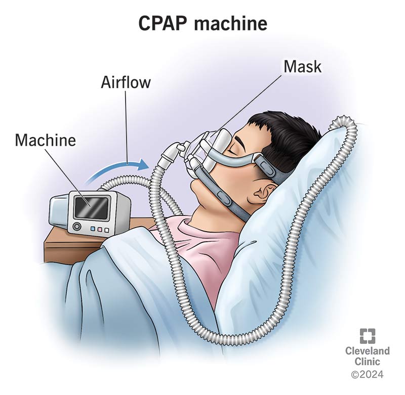 CPAP Machine