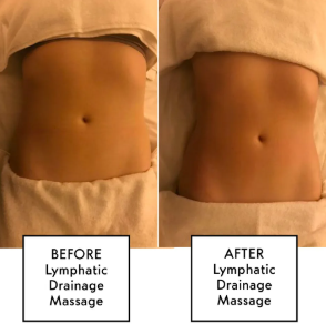 LYMPHATIC DRAINAGE MASSAGE - 30 MINUTE