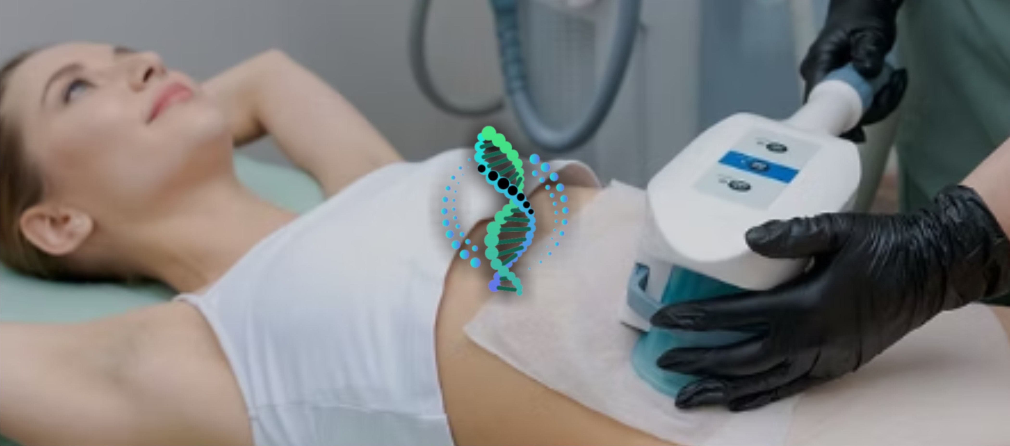 FAT FREEZING TREATMENT - 4 SESSIONS