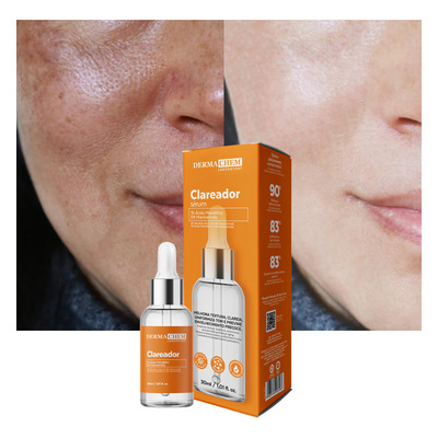 سيروم تفتيح البقع والكلف – استخدام نهاري وليلي - نياسينامايد %5