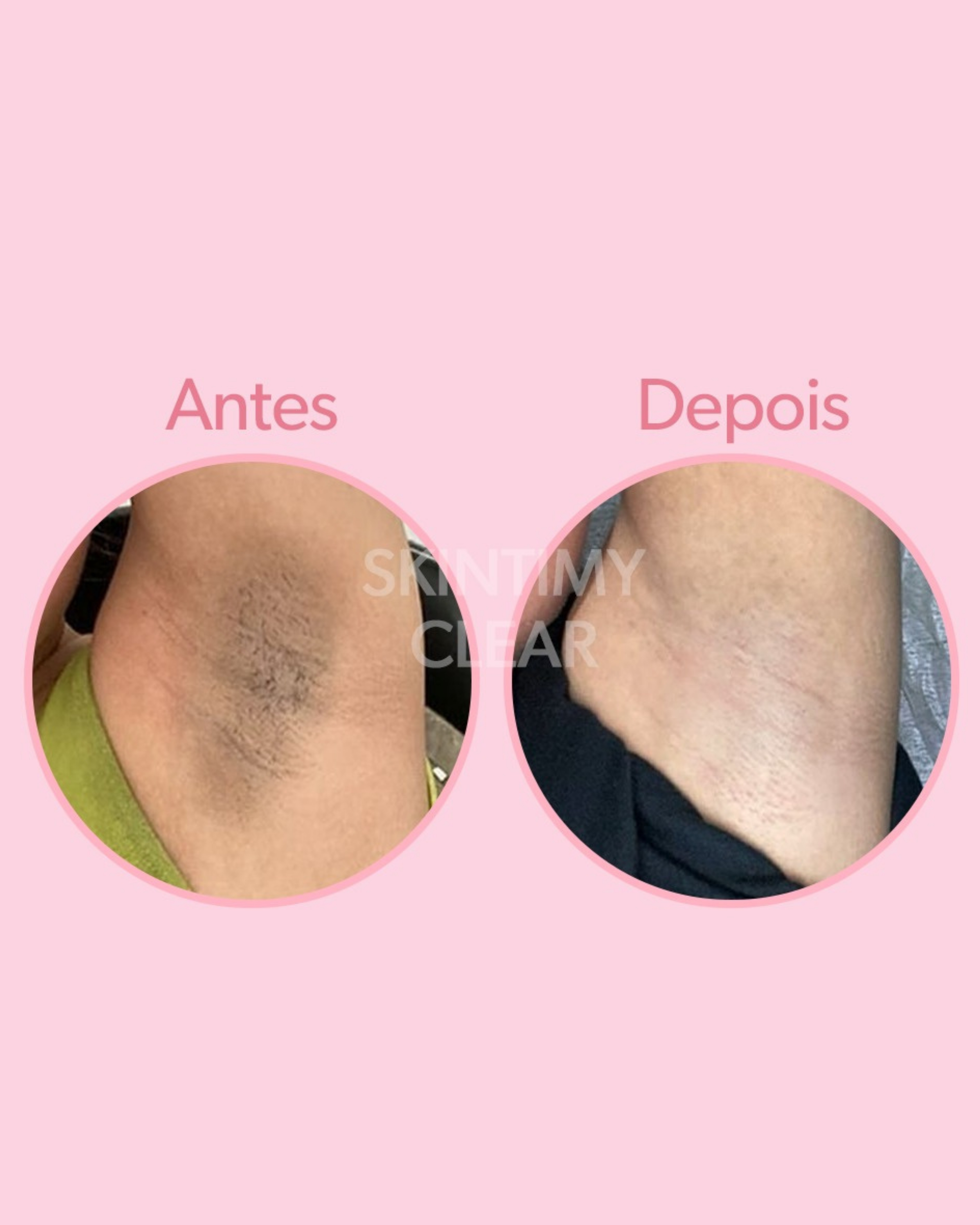  سيرم تفتيح المناطق الانثوية