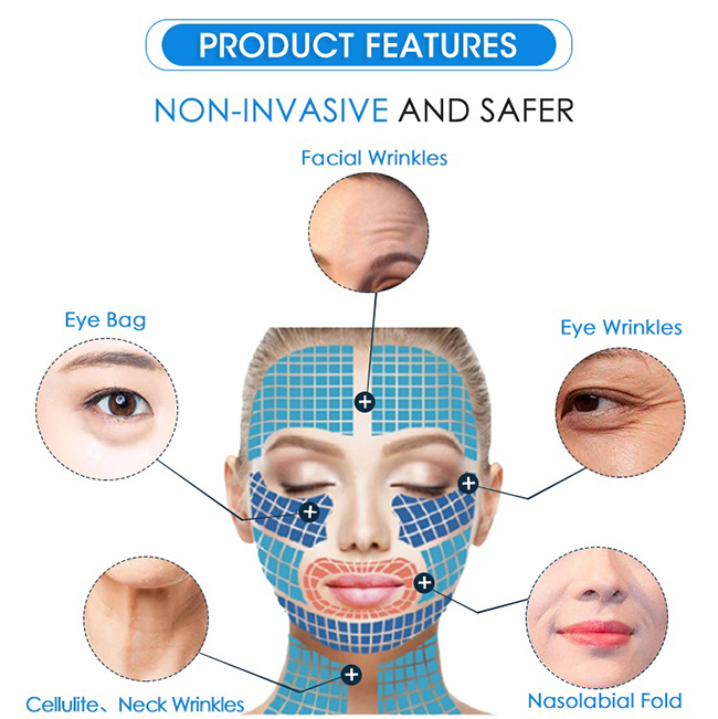 exilis ultra 360 rf face lifting cellulite removal body silmming machine